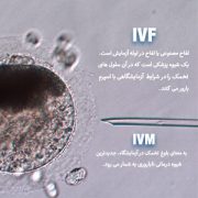 درمان ناباروری با IVF-IVM