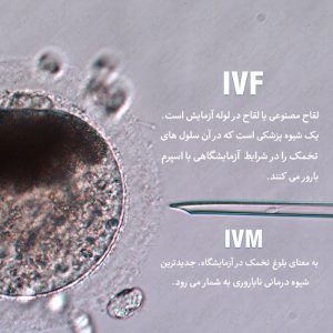 درمان ناباروری با IVF-IVM